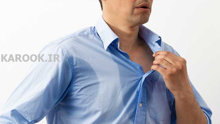 تعریق زیاد نشانه چیست ، هایپرهیدروزیس